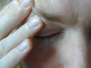a face covered by a hand